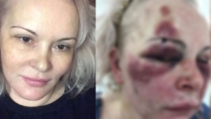 Sosyal medyada tanıştığı kişi otel odasında kabusu yaşattı! 'Kanlar bulaşınca tadı ne güzel diyordu'