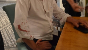 CHP'Lİ BELEDİYE BAŞKANINA SALDIRI !