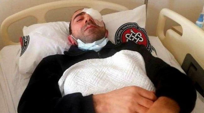 Avcılar Belediyesi çalışanına saldırı: Gözünde yüzde 90 görme kaybı oluştu