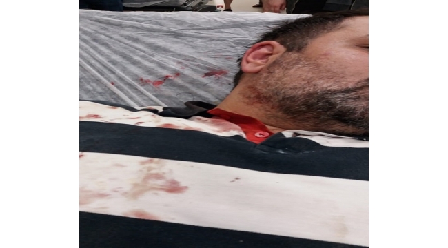 Büyükadada'da gazeteci Güngör feci şekilde darp edildi!