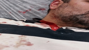 Büyükadada'da gazeteci Güngör feci şekilde darp edildi! 