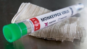 Türkiye'de ilk maymun çiçeği vakası tespit edildi