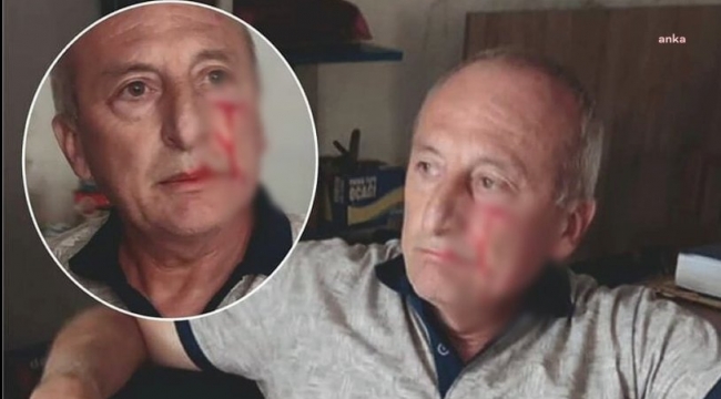 CHP'li Yarbaşı Belediye Başkanı Mustafa Kaynar'a saldırı!