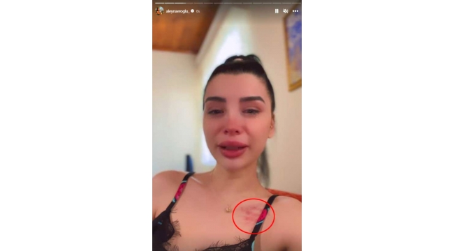 Aleyna Eroğlu, Batuhan Karadeniz'den şiddet gördüğünü iddia etti