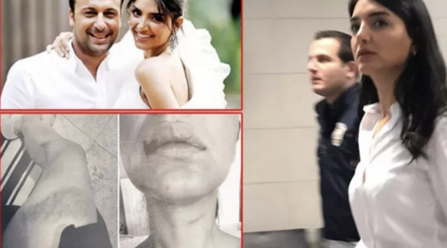 Ünlü iş adamıyla ilgili şok ifade! Sırtıma öyle sert bir darbe aldım ki nefessiz kaldım