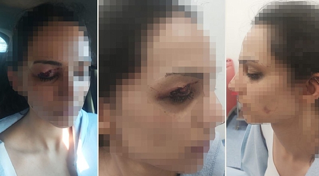 Polisin karısına, ilçe emniyette meslektaş dayağı